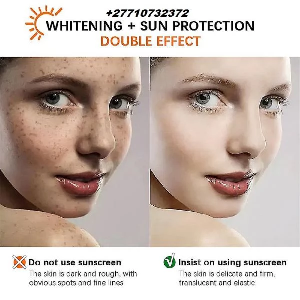 Skin Whitening In Tabora Municipality in Tanzania Pimple Treatment In Newton City in Massachusetts